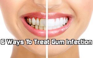 six way to treat dental surgery guru
